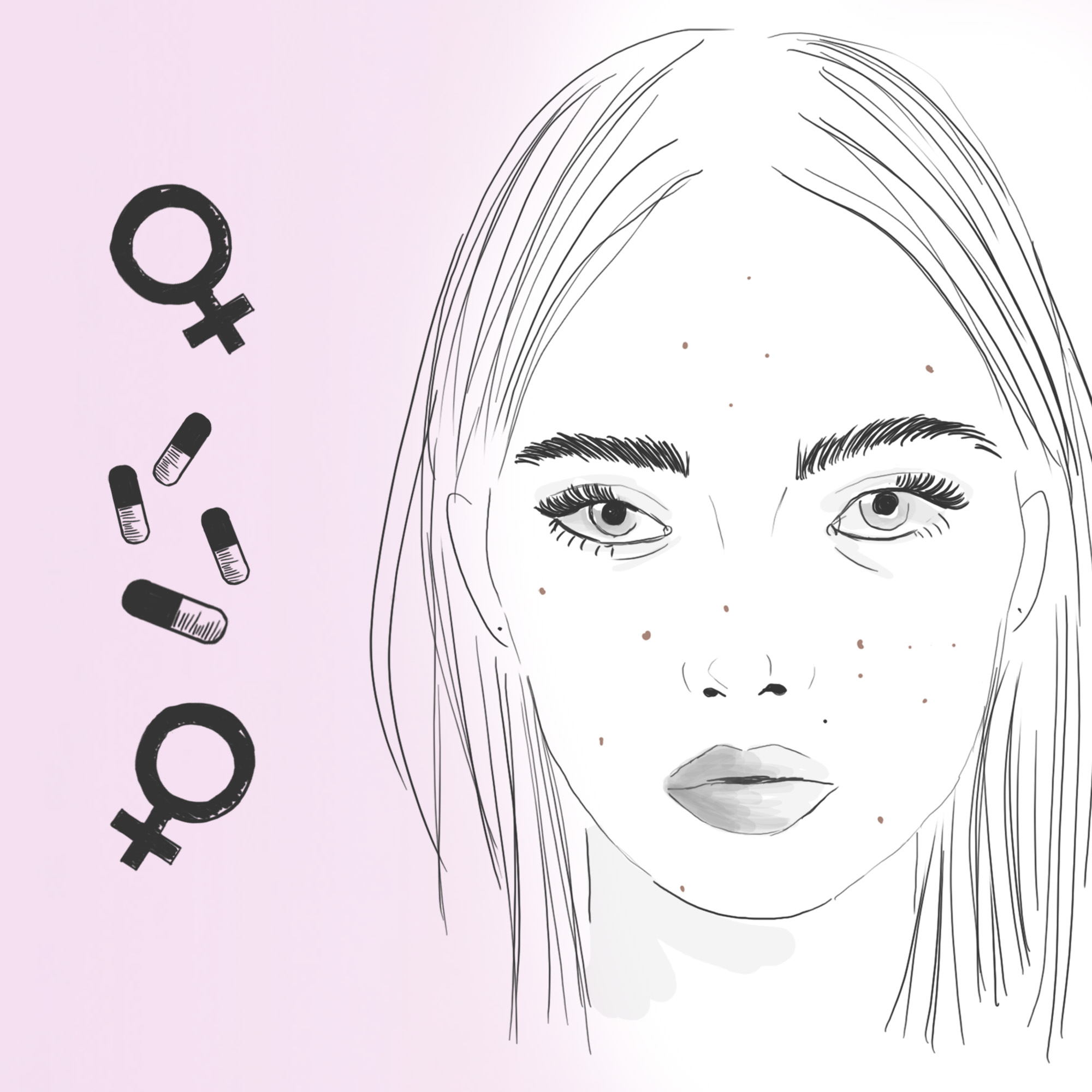 Nunca se me va a quitar esto?»: Mi experiencia con el acné hormonal –  Ideario Blog